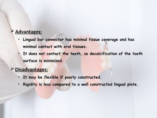 MAJOR CONNECTORS IN REMOVABLE PARTIAL DENTURE | PPTX