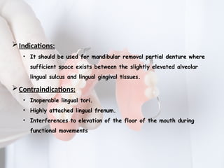 MAJOR CONNECTORS IN REMOVABLE PARTIAL DENTURE | PPTX