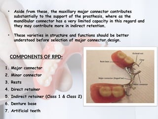 Direct Rpd MAJOR CONNECTORS IN REMOVABLE PARTIAL DENTURE | PPTX
