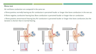 6. Middle ear.pptx anatomy pathophysio disease | PPTX