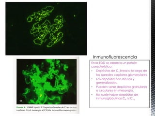 6. Glomerulonefritis membranoproliferativa y por IgA.pptx