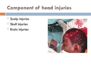 Skull Potential Injuries Comprehensive Management of Head Injury: Causes, Diagnosis, and ...