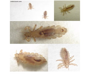 Comprehensive Overview of Lice: Types, Transmission, Diseases, and ...