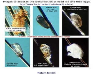 Comprehensive Overview of Lice: Types, Transmission, Diseases, and ...
