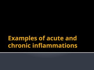 Comprehensive Overview of Acute and Chronic Inflammation in Medical ...