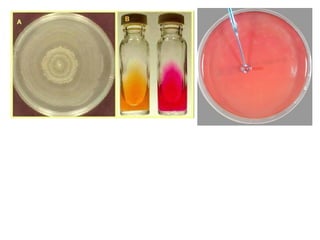 Comprehensive Overview of Proteus Species: Characteristics ...