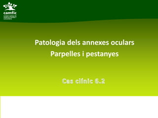 Patologia dels annexes oculars
    Parpelles i pestanyes
 