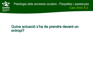 Patologia dels annexes oculars - Parpelles i pestanyes
Patologia dels annexes oculars                    Cas clínic 6.2
Cas clínic 6.2




          Quina actuació s’ha de prendre davant un
          entropi?
 