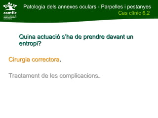 Patologia dels annexes oculars - Parpelles i pestanyes
Patologia dels annexes oculars                Cas clínic 6.2
Cas clínic 6.2



     Quina actuació s’ha de prendre davant un
     entropi?

Cirurgia correctora.

Tractament de les complicacions.
 