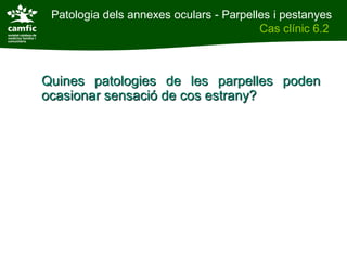 Patologia dels annexes oculars - Parpelles i pestanyes
Patologia dels annexes oculars                    Cas clínic 6.2
Cas clínic 6.2



          Quines patologies de les parpelles poden
          ocasionar sensació de cos estrany?
 