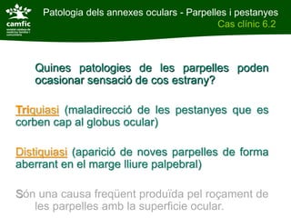 Patologia dels annexes oculars - Parpelles i pestanyes
Patologia dels annexes oculars                Cas clínic 6.2
Cas clínic 6.2



     Quines patologies de les parpelles poden
     ocasionar sensació de cos estrany?

Triquiasi (maladirecció de les pestanyes que es
corben cap al globus ocular)

Distiquiasi (aparició de noves parpelles de forma
aberrant en el marge lliure palpebral)

Són una causa freqüent produïda pel roçament de
   les parpelles amb la superficie ocular.
 