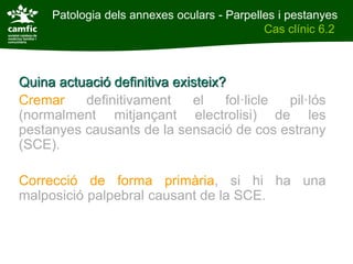 Patologia dels annexes oculars - Parpelles i pestanyes
Patologia dels annexes oculars                Cas clínic 6.2
Cas clínic 6.2



Quina actuació definitiva existeix?
Cremar    definitivament     el    fol·licle pil·lós
(normalment mitjançant electrolisi) de les
pestanyes causants de la sensació de cos estrany
(SCE).

Correcció de forma primària, si hi ha una
malposició palpebral causant de la SCE.
 