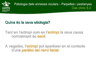 Patologia dels annexes oculars - Parpelles i pestanyes
Patologia dels annexes oculars                Cas clínic 6.2
Cas clínic 6.2



Quina és la seva etiologia?

Tant en l’ectropi com en l’entropi la seva causa
   normalment és senil.

A vegades, l’ectropi pot aparèixer en el contexte
   d’una paràlisi del nervi facial.
 