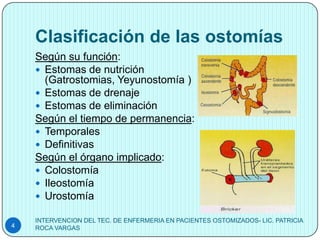 Clasificación de las ostomías
    Según su función:
     Estomas de nutrición
      (Gatrostomias, Yeyunostomía )
     Estomas de drenaje
     Estomas de eliminación
    Según el tiempo de permanencia:
     Temporales
     Definitivas
    Según el órgano implicado:
     Colostomía
     Ileostomía
     Urostomía

    INTERVENCION DEL TEC. DE ENFERMERIA EN PACIENTES OSTOMIZADOS- LIC. PATRICIA
4   ROCA VARGAS
 