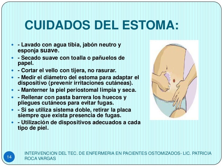 Cuidados De Enfermeria En Pacientes Ostomizados