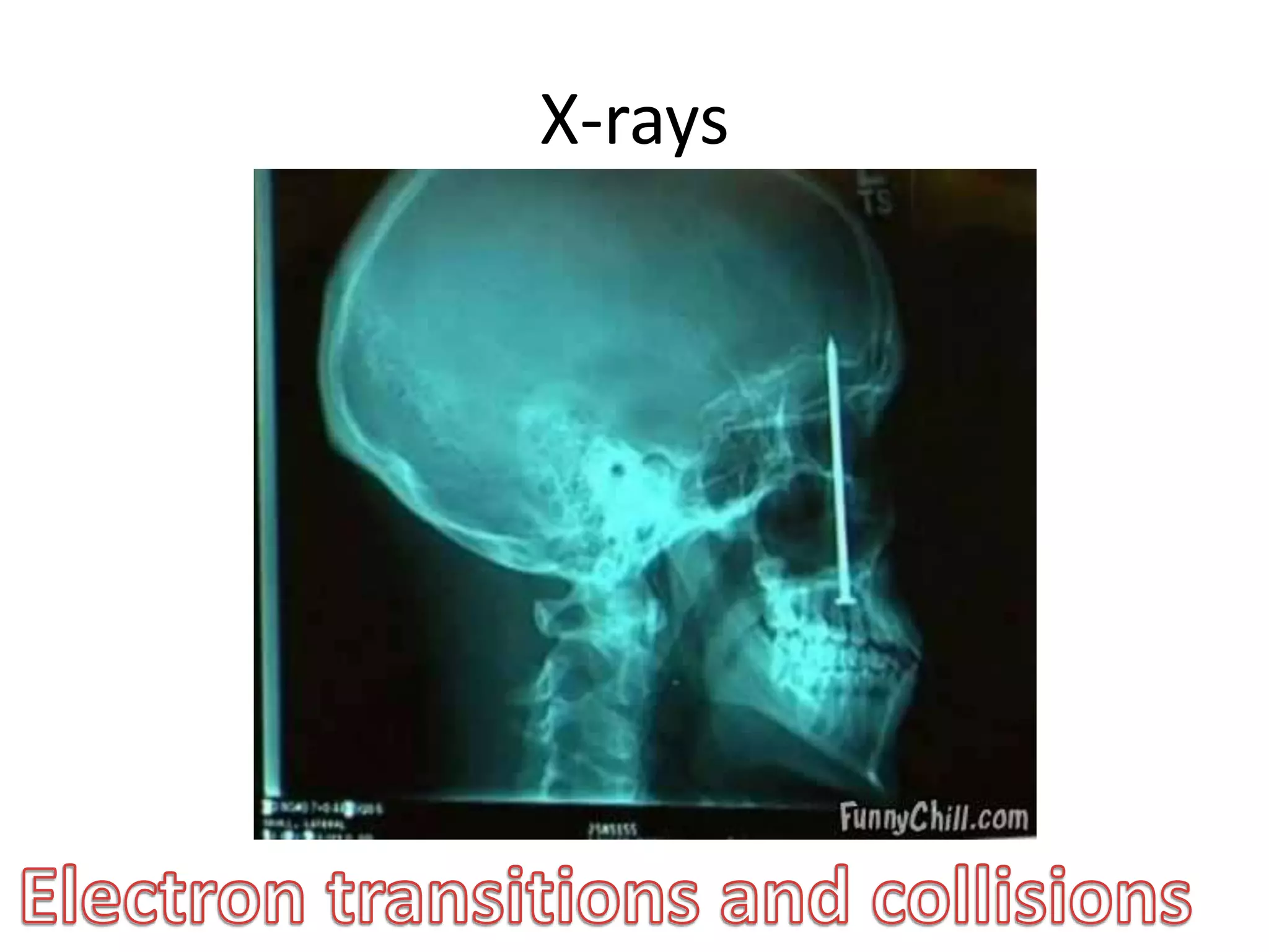 X-rays
 