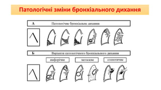 Патологічні зміни бронхіального дихання
 