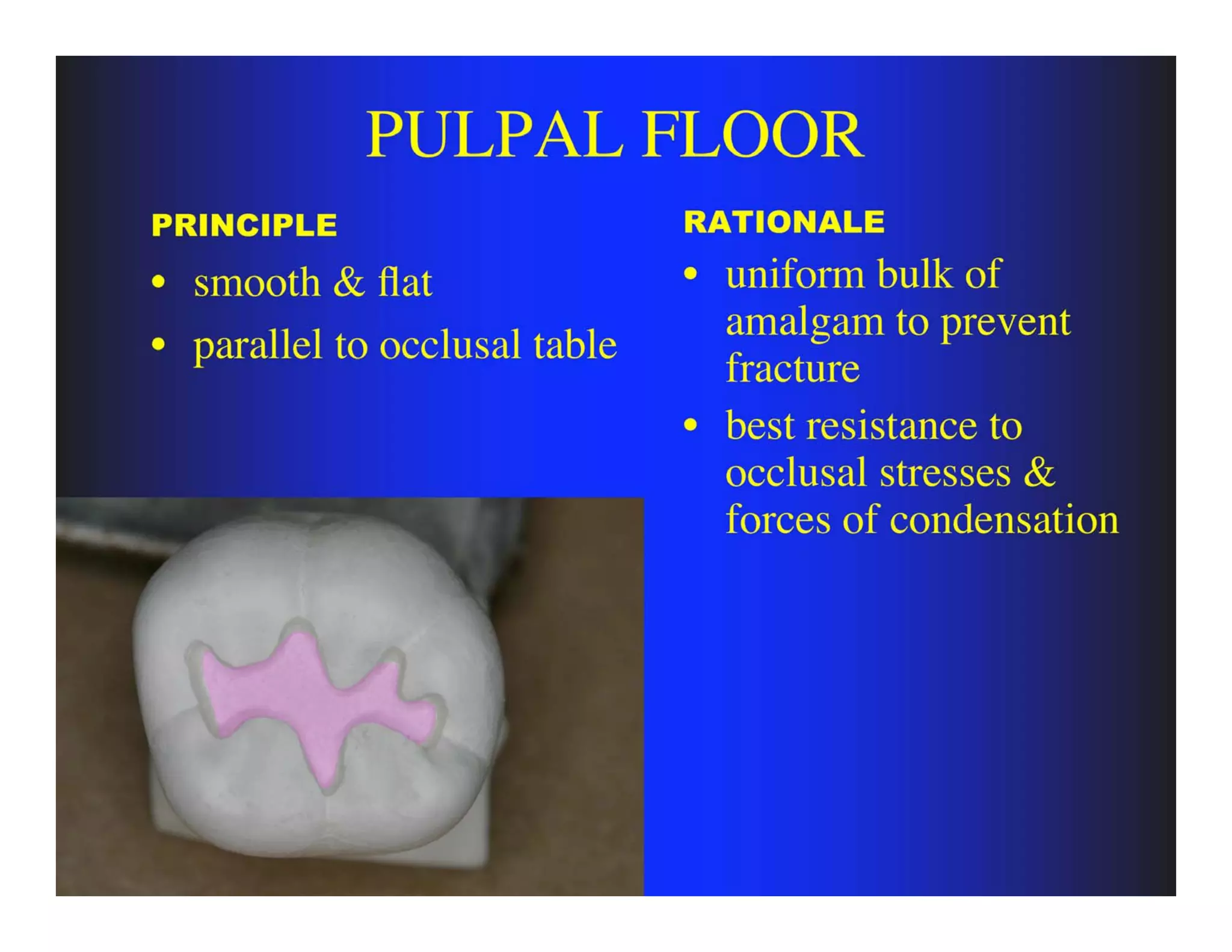 Pulpal Classification principles of tooth preparation (class one) | PDF | Dental Health ...
