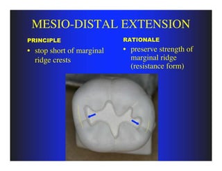 principles of tooth preparation (class one) | PDF