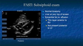 FAST: Subxiphoid exam
 Normal Anatomy
 Liver at very top of screen
 Epicardial fat vs. effusion
 Thin layer anterior to
RV
 Not present posterior
to LV
Anterior
Posterior
Left
Right
 