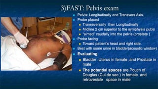 3)FAST: Pelvis exam
 Pelvis: Longitudinally and Transvers Axis.
 Probe placed
 Transeversally then Longitudinally
 Midline 2 cm superior to the symphysis pubis
 “aimed” caudally into the pelvis (prostate )
 Probe facing
 Toward patient’s head and right side.
 Best with some urine in bladder(acoustic window)
 Evaluating
 Bladder ,Uterus in female ,and Prostate in
male
 The potential spaces are Pouch of
Douglas (Cul de sac ) in female and
retrovesicle space in male
 