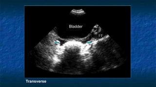 Bladder
FF
Transverse
 