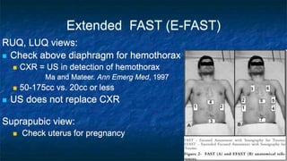 Extended FAST (E-FAST)
RUQ, LUQ views:
 Check above diaphragm for hemothorax
 CXR = US in detection of hemothorax
Ma and Mateer. Ann Emerg Med, 1997
 50-175cc vs. 20cc or less
 US does not replace CXR
Suprapubic view:
 Check uterus for pregnancy
 