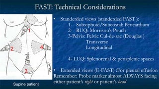 FAST: Technical Considerations
• Standerded views (standerded FAST ):
1- Subxiphoid/Subcostal: Pericardium
2- RUQ: Morrison’s Pouch
3-Pelvis: Pelvic Cul-de-sac (Douglas )
Transverse
Longitudinal
4- LUQ: Splenorenal & perisplenic spaces
• Extended views (E-FAST) :For pleural effusion
Remember: Probe marker almost ALWAYS facing
either patient’s right or patient’s head
Supine patient
1
4
2
3
 