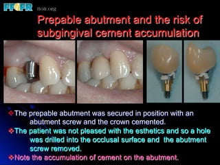 Prepable abutment and the risk of
         subgingival cement accumulation




v The prepable abutment was secured in position with an
       abutment screw and the crown cemented.
v The patient was not pleased with the esthetics and so a hole
       was drilled into the occlusal surface and the abutment
       screw removed.
v Note the accumulation of cement on the abutment.
 