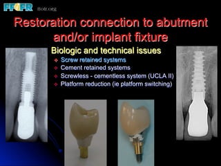 Restoration connection to abutment
       and/or implant fixture
      Biologic and technical issues
       v    Screw retained systems
       v    Cement retained systems
       v    Screwless - cementless system (UCLA II)
       v    Platform reduction (ie platform switching)
 