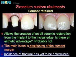 Zirconium custom abutments
                    Cement retained




v  Allows the creation of an all ceramic restoration
    from the implant to the incisal edge. Is there an
    esthetic advantage? Probably not
v  The main issue is positioning of the cement
    margin
v  Incidence of fracture has yet to be determined.
 