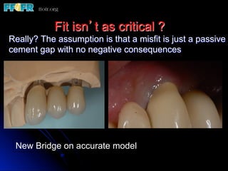 Fit isn’t as critical ?
Really? The assumption is that a misfit is just a passive
cement gap with no negative consequences




 New Bridge on accurate model
 