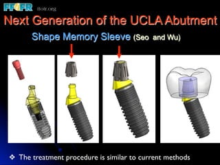 Next Generation of the UCLA Abutment
       Shape Memory Sleeve (Seo               and Wu)




❖  The treatment procedure is similar to current methods	

 