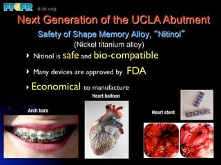 Next Generation of the UCLA Abutment
      Safety of Shape Memory Alloy, “Nitinol”
               (Nickel titanium alloy)
 ‣  Nitinol is safe and bio-compatible	

 ‣  Many devices are approved by FDA	

 ‣  Economical to manufacture	

                     Heart balloon

  Arch bars
                              Heart stent
 