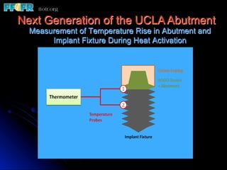 Next Generation of the UCLA Abutment
  Measurement of Temperature Rise in Abutment and
       Implant Fixture During Heat Activation
 