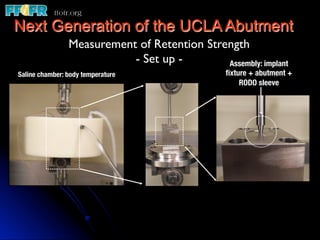 Next Generation of the UCLA Abutment
                Measurement of Retention Strength	

                           - Set up -	

     Assembly: implant
Saline chamber: body temperature
               ﬁxture + abutment +
                                                    RODO sleeve
 