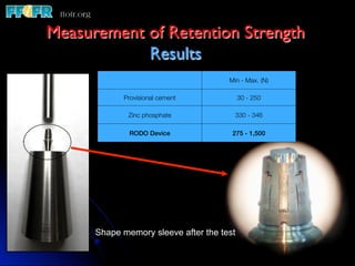 Measurement of Retention Strength	

            Results 	

                                      Min - Max. (N)

            Provisional cement
            30 - 250

              Zinc phosphate
           330 - 346

              RODO Device!             275 - 1,500!




      Shape memory sleeve after the test
 