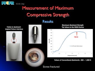 Measurement of Maximum
                        Compressive Strength 	

                                Results    	

                                                     Maximum Abutment Strength
  Failed at abutment-                               *No failure in the RODO Device
implant ﬁxture interface



                                                                     750 N




                                           Failure of Conventional Abutments : 800 ~ 1,000 N


                                 Screw fractured
 