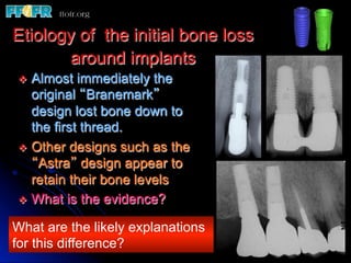 Etiology of the initial bone loss
       around implants
v  Almost   immediately the
    original “Branemark”
    design lost bone down to
    the first thread.
v  Other designs such as the
    “Astra” design appear to
    retain their bone levels
v  What is the evidence?

What are the likely explanations
for this difference?
 