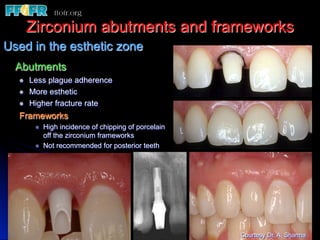 Zirconium abutments and frameworks
Used in the esthetic zone
  Abutments
  l    Less plague adherence
  l    More esthetic
  l    Higher fracture rate
  Frameworks
         l    High incidence of chipping of porcelain
               off the zirconium frameworks
         l    Not recommended for posterior teeth




                                                         Courtesy Dr. A. Sharma
 