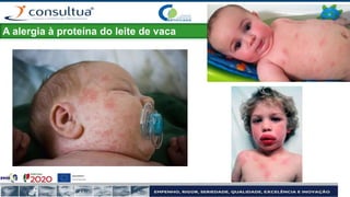 A alergia à proteína do leite de vaca
 