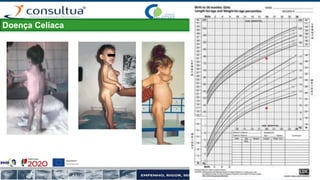 Doença Celíaca
 