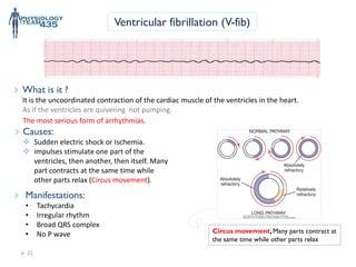 Cardiac Arrhythmias complete detailed lecture .pdf