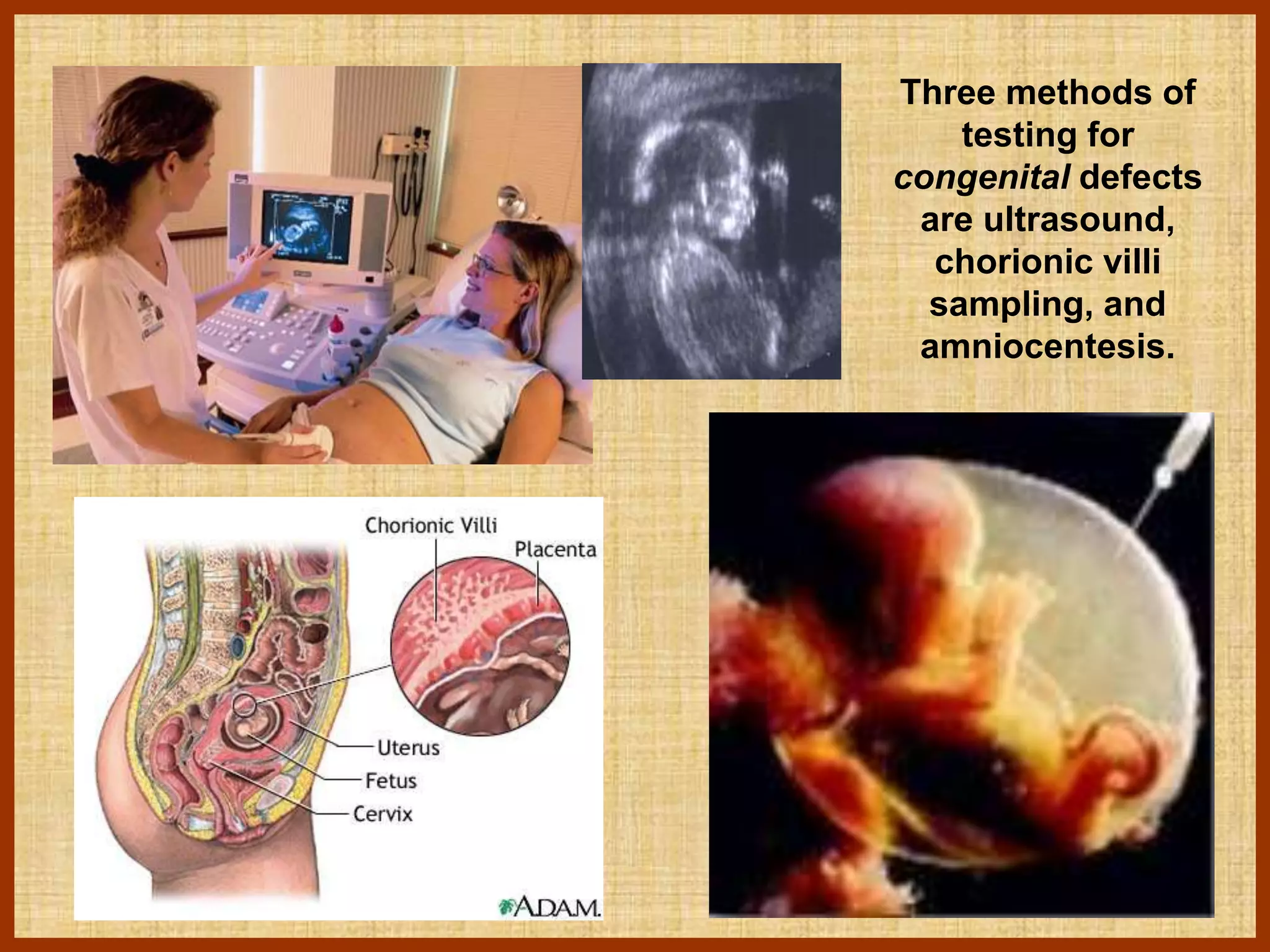 Graphical Abstract Birth Defect 6-Birth-Defects.ppt