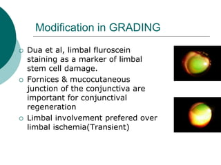 Chemical-burn | PPT
