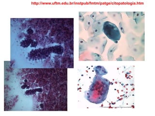 http://www.uftm.edu.br/instpub/fmtm/patge/citopatologia.htm
 