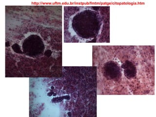 http://www.uftm.edu.br/instpub/fmtm/patge/citopatologia.htm
 