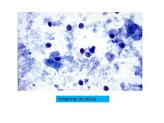 Fenômeno da citólise
 