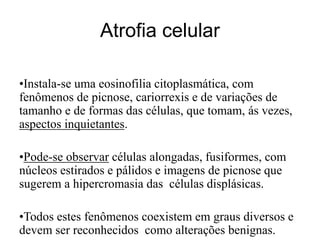 •Instala-se uma eosinofilia citoplasmática, com
fenômenos de picnose, cariorrexis e de variações de
tamanho e de formas das células, que tomam, ás vezes,
aspectos inquietantes.
•Pode-se observar células alongadas, fusiformes, com
núcleos estirados e pálidos e imagens de picnose que
sugerem a hipercromasia das células displásicas.
•Todos estes fenômenos coexistem em graus diversos e
devem ser reconhecidos como alterações benignas.
Atrofia celular
 