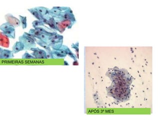 PRIMEIRAS SEMANAS
APÓS 3º MES
 